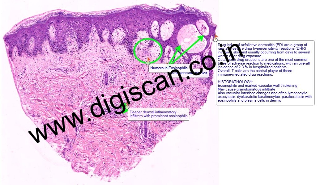 Dermatopathology Digital Slides Set (Skin Lesions, Infections & Tumors)